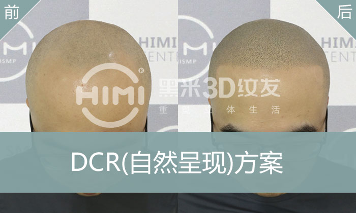 DCR自然呈现方案