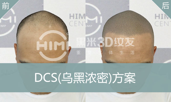 DCS乌黑浓密方案