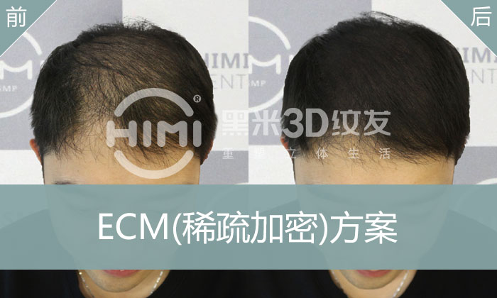 ECM稀疏加密方案
