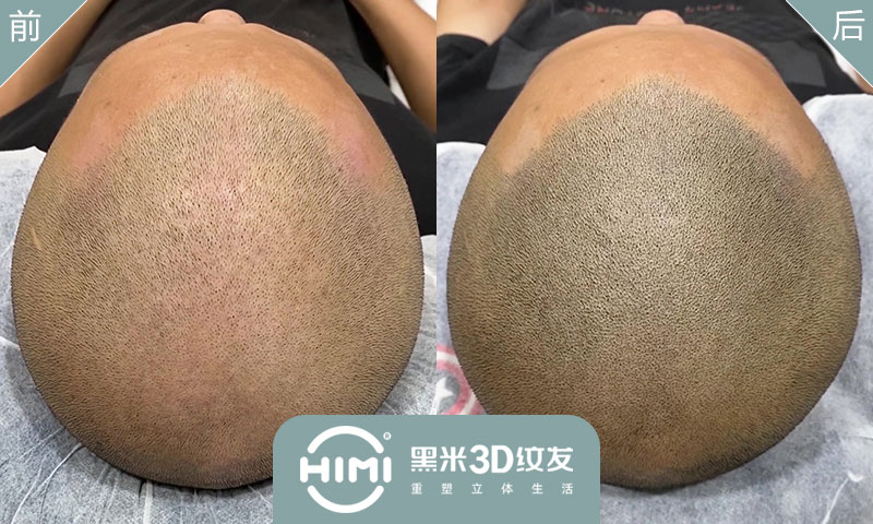 纹发能保持几年？黑米3d纹发能保持多久？