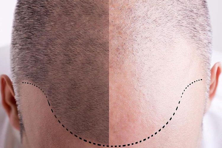 黑米3D纹发是不是纹身