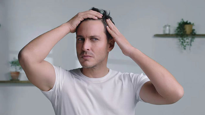 纹发和假发怎么选择？