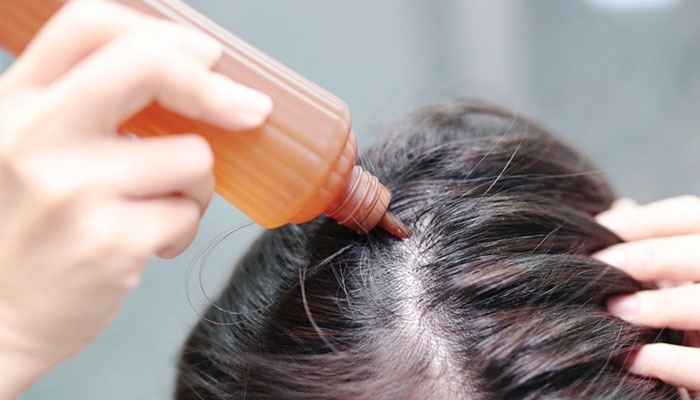 解决脱发的方法有哪些?外用生发治疗 解决脱发的方法有哪些?外用生发治疗