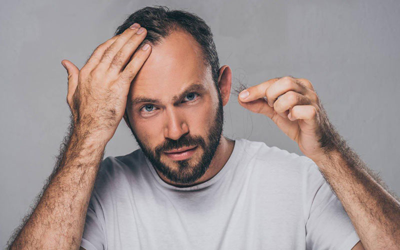 男朋友脱发怎么办