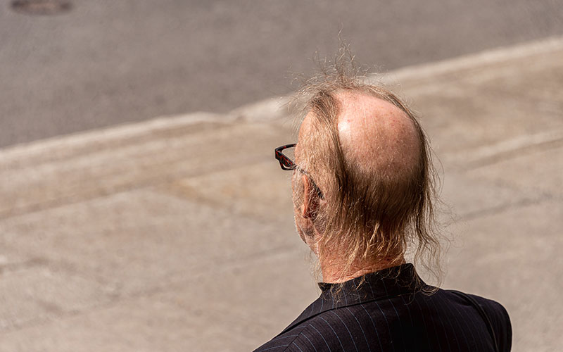 头皮纹发操作流程是怎么样？