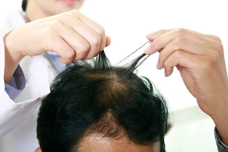 纹发前咨询专业人士