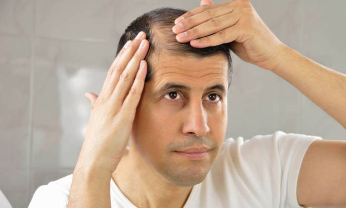 一位脱发的男性在镜子前仔细检查头发