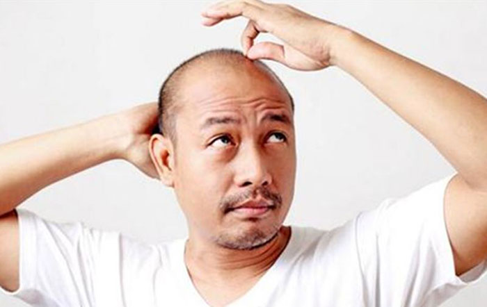 成都SMP纹发哪家好