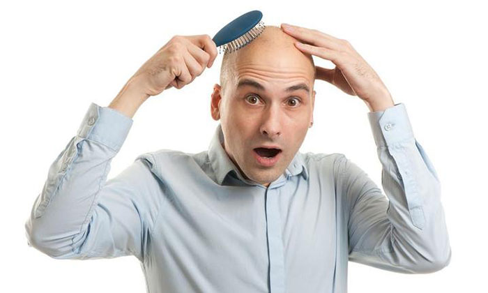 光头纹发：男士时尚新选择