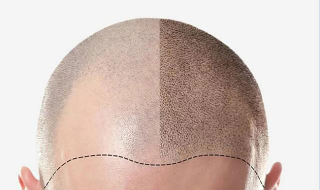 3D纹发安全吗？了解黑米3D纹发的安全性