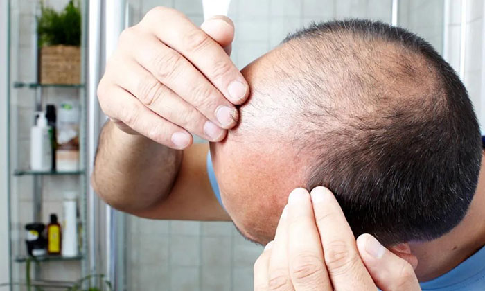 纹发对头皮有伤害吗？