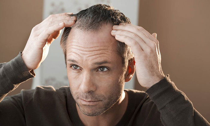 脱发后想靠纹发挽回形象，3d纹发值得信任吗?