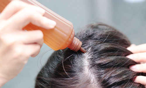 脱发严重能用米诺吗？解析效果与纹发新选择