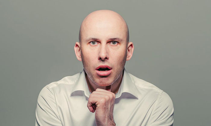 黑米SFP纹发真实效果如何？