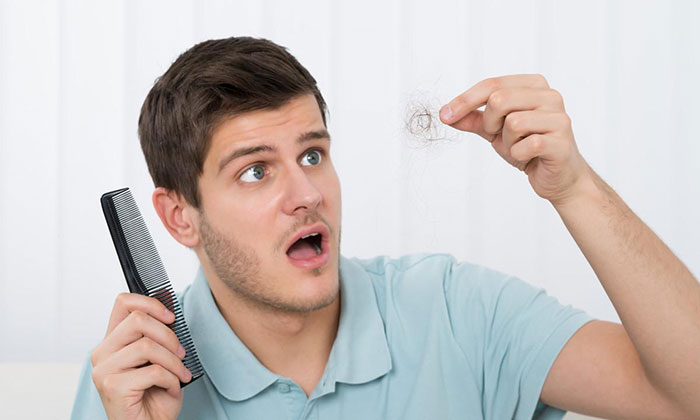 24岁脱发太严重怎么办? 24岁脱发太严重怎么办?