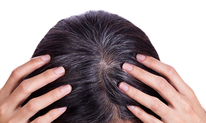 头发油腻又脱发怎么办? 头发油腻又脱发怎么办?