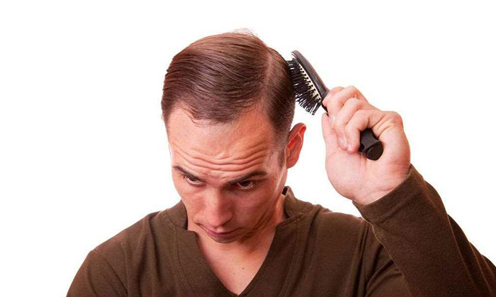 头皮纹发的效果与注意事项