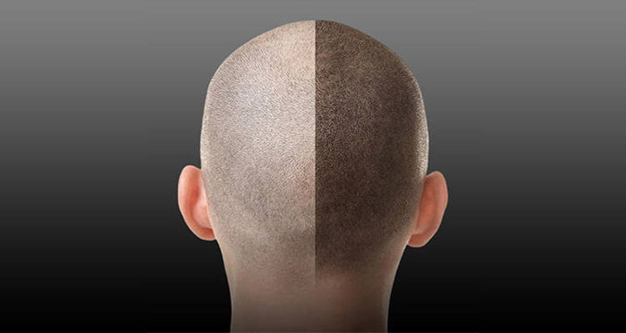 纹发密发专业门店大全