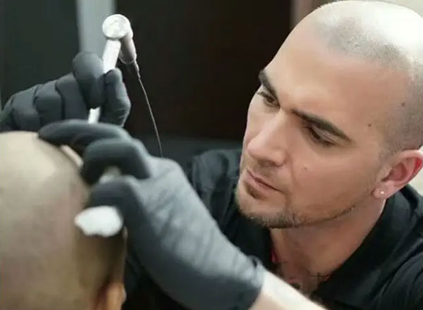 纹发能维持几年