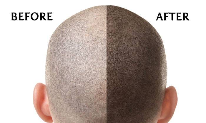 纹发是终身的吗? 纹发是终身的吗?