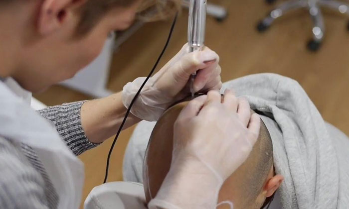 纹发操作 纹发操作