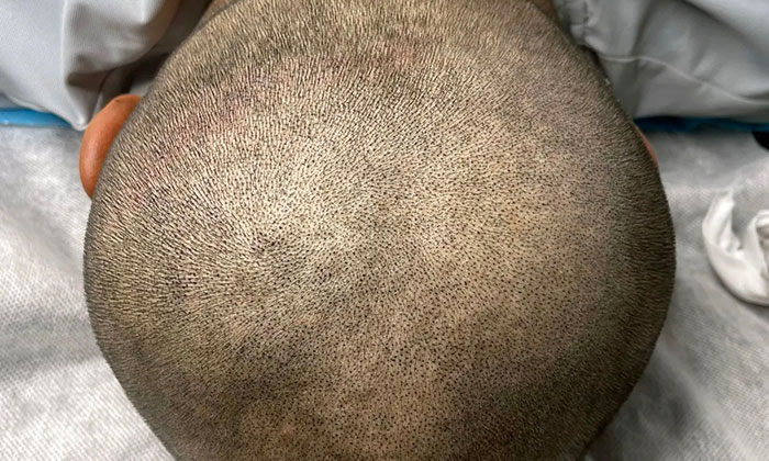 纹发后颜色会掉吗？