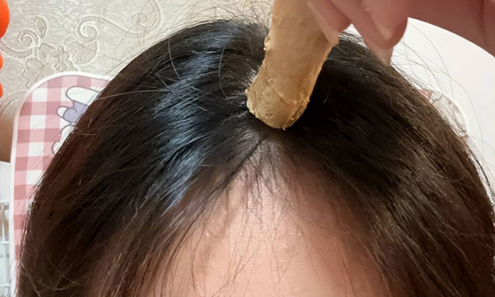 偏方生姜擦头皮?小心脱发加重! 偏方生姜擦头皮?小心脱发加重!