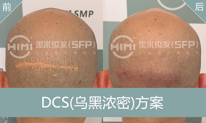 刀疤纹发效果前后对比