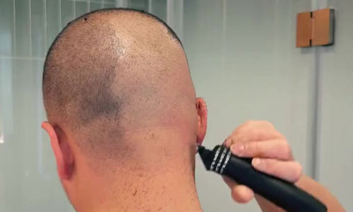 剃头养发可行吗?解析剃头与养发关系,纹发改善脱发形象