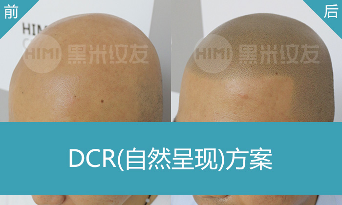 DCR自然呈现