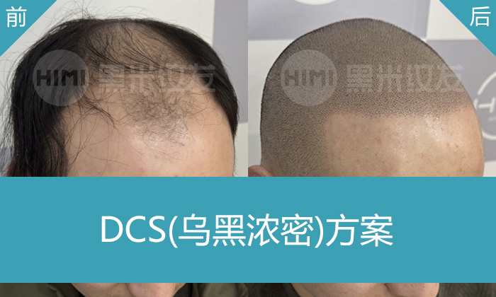 DCS乌黑浓密