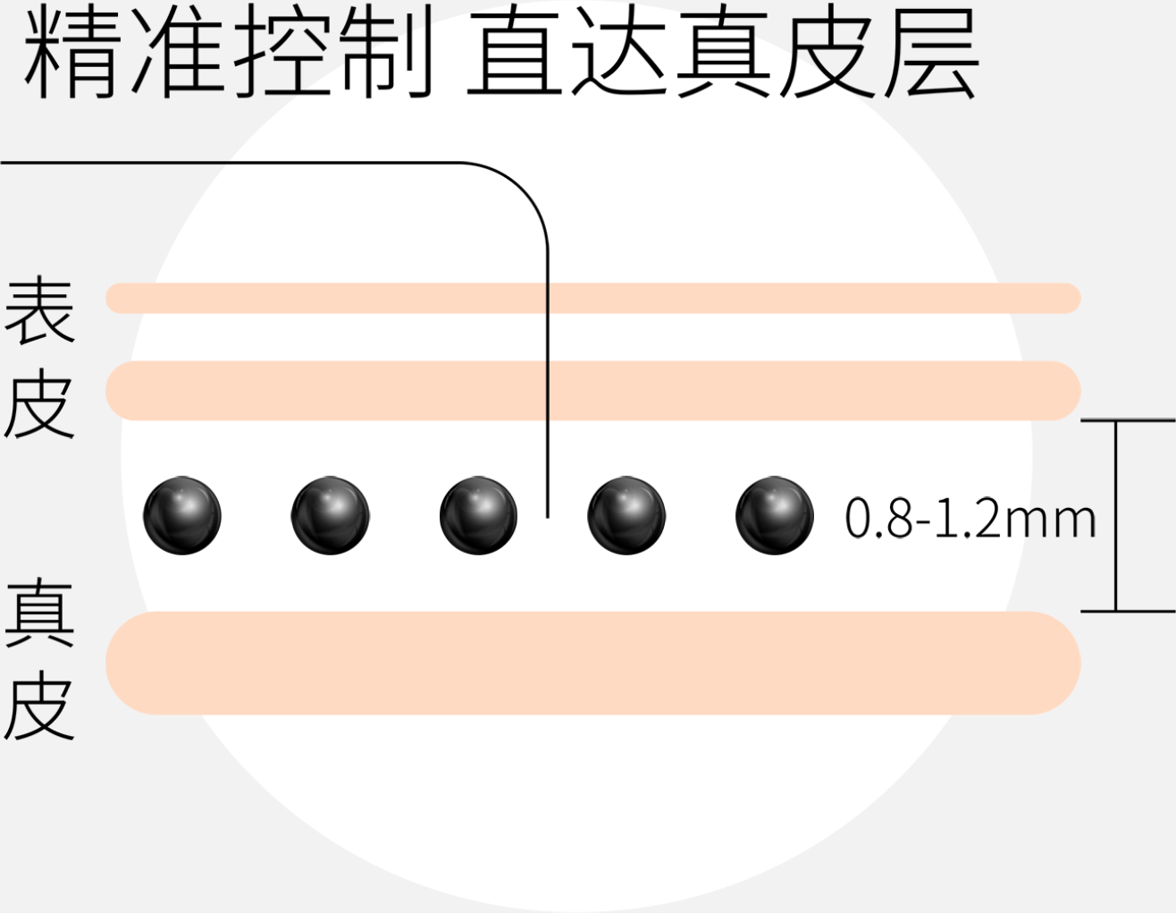 黑米纹发(SFP)