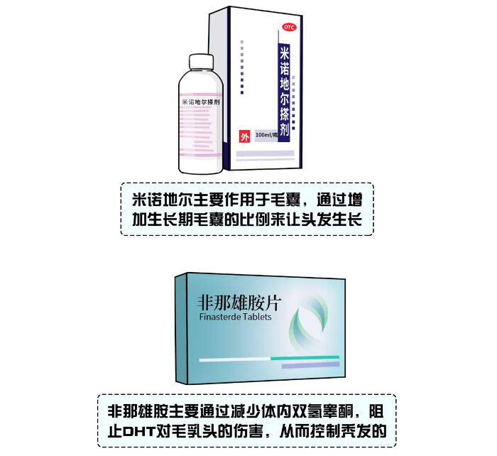 米诺地尔和非那雄胺 米诺地尔和非那雄胺