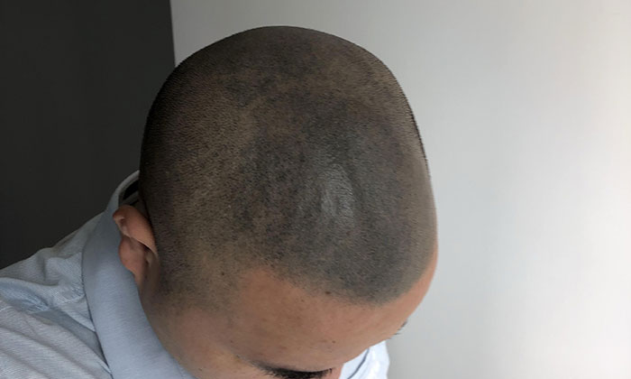 纹发失败后期模糊 纹发失败后期模糊