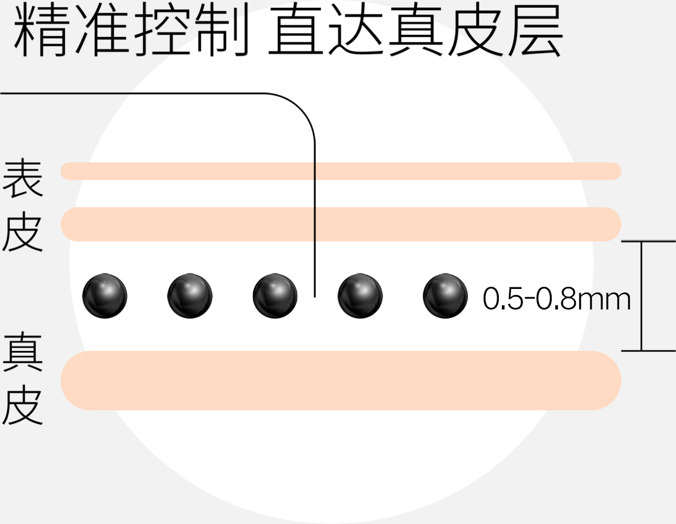 黑米纹发(SFP)技术，精准控制，直达真皮层
