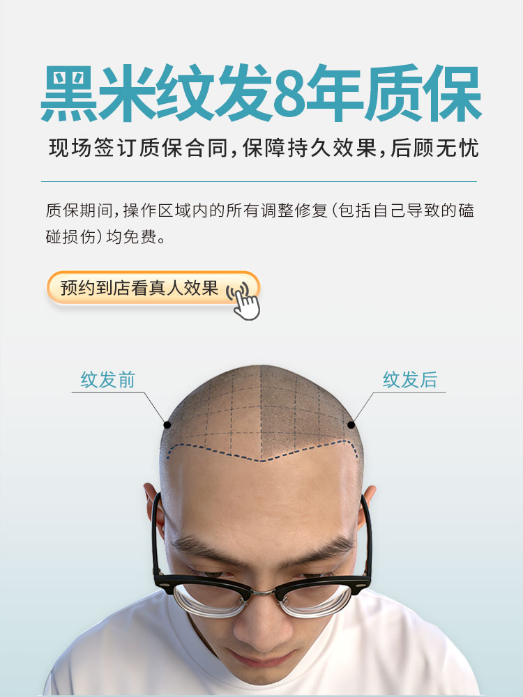 黑米纹发8年质保，现场签订质保合同，保障持久效果，后顾无忧