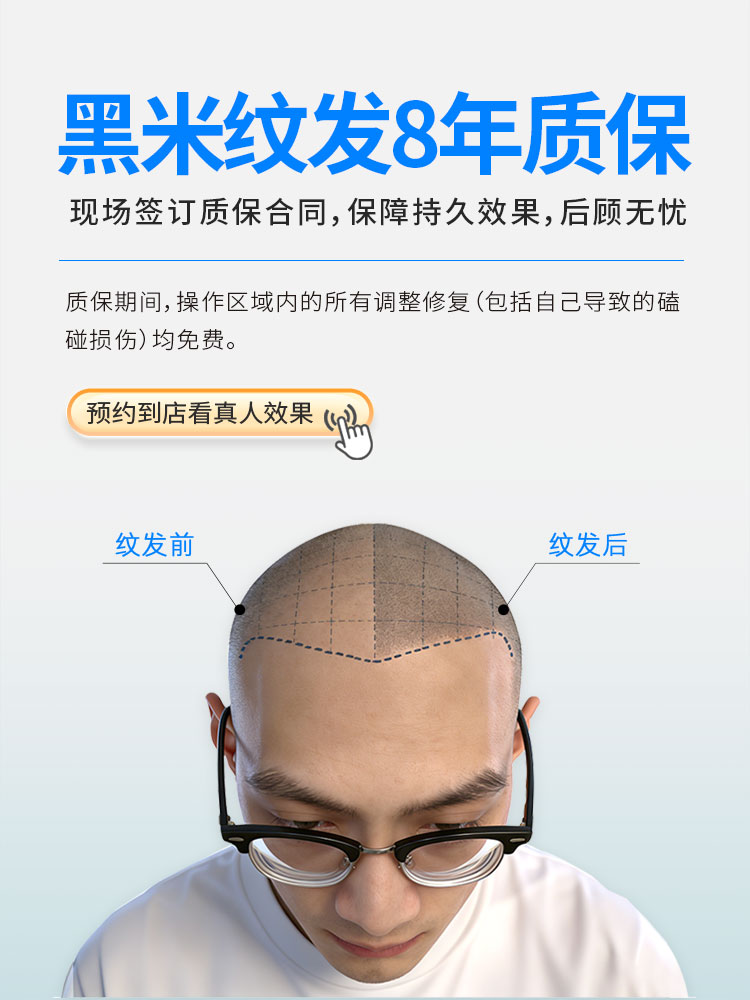 黑米纹发8年质保，现场签订质保合同，保障持久效果，后顾无忧