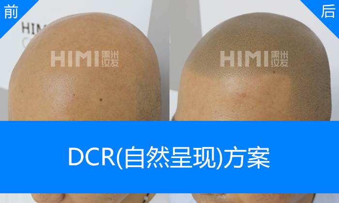 DCR自然呈现