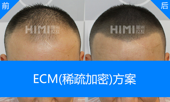 ECM稀疏加密