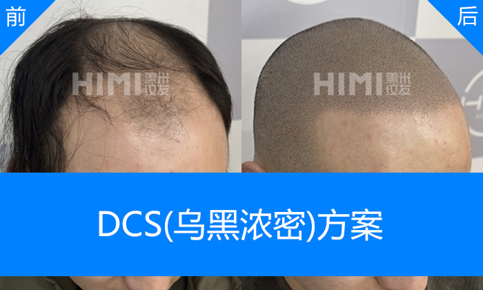 DCS乌黑浓密