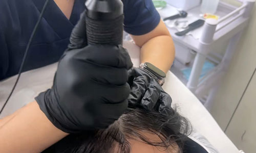 女生不剃头能纹发吗？详解女性非剃发纹发技术与效果